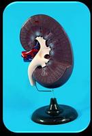 Модель почки в разрезе