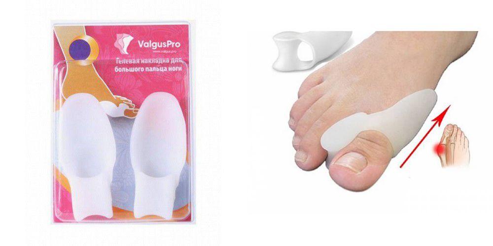 Фиксатор для большого пальца Вальгус Про (Valgus Pro) от выступающей косточки на ногах, дневной