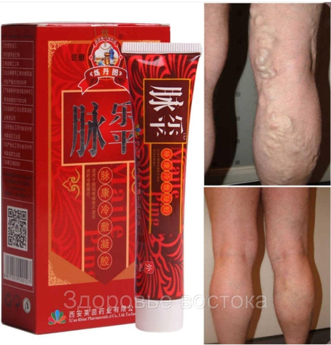 Какой мазью мазать варикоз. Какой мазью мазать варикоз. Мазь от воспаления вен на ногах. Варикозное расширение вен нижних конечностей мази. Крем от варикозного расширения вен.
