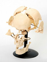 Кости черепа человека, смонтированные на подставке