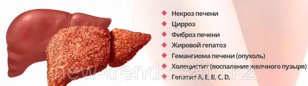 Жировая печень что кушать