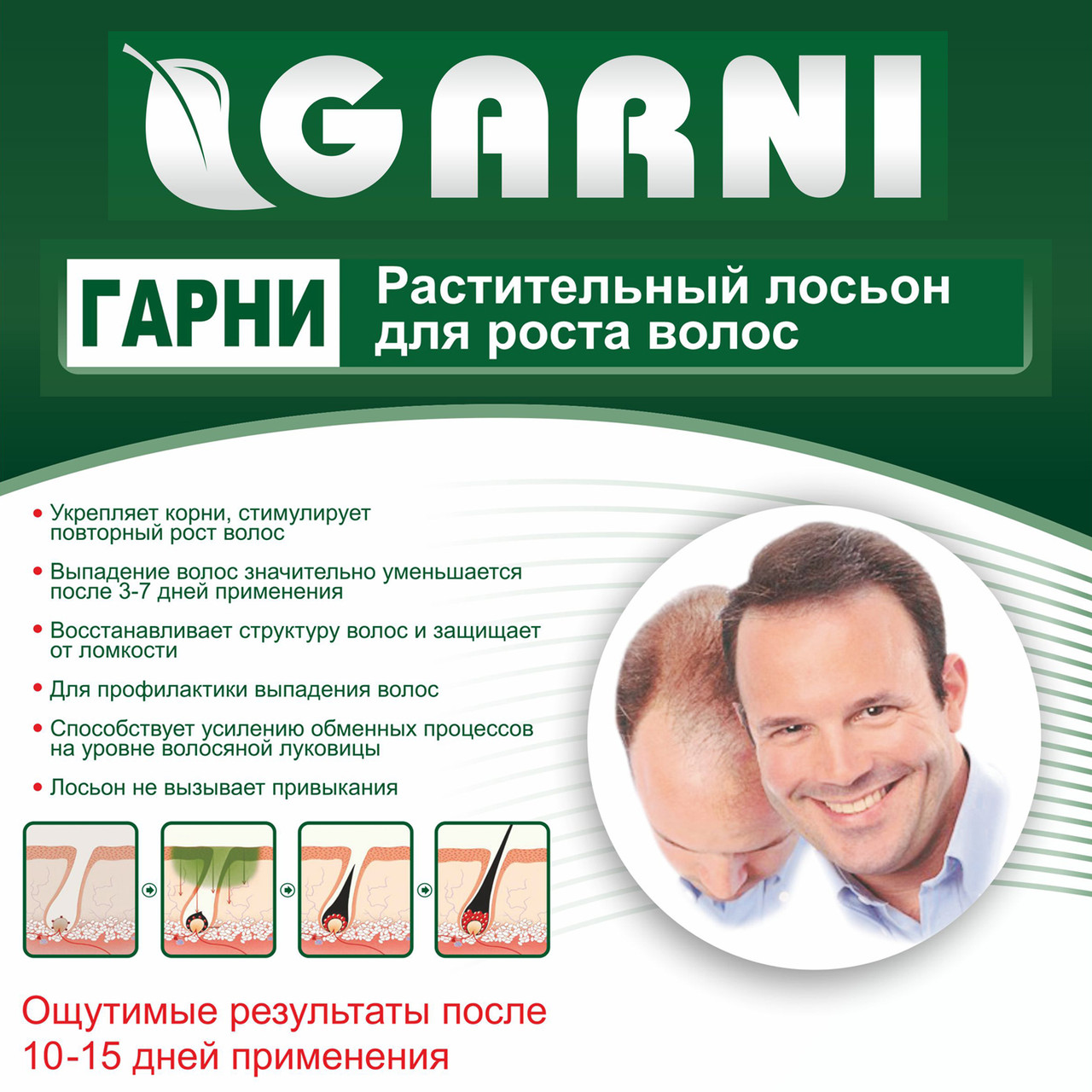 Растительный лосьон для роста волос и против выпадения, Garni Гарни, 30мл - фото 3 - id-p101082979