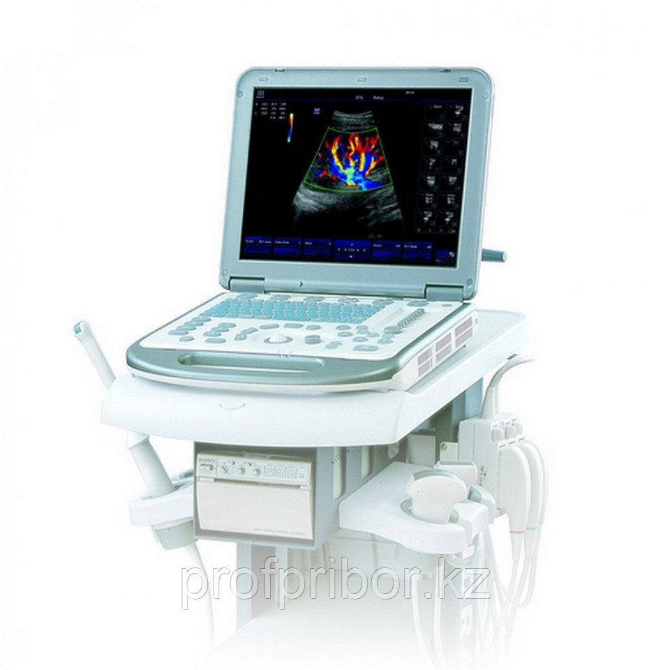 Аппарат ультразвуковой диагностики Mindray M5 (УЗИ-сканер): продажа ...
