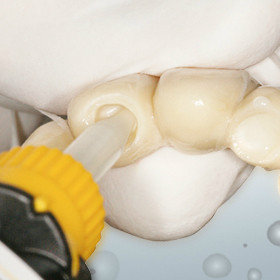 стоматологические цементы