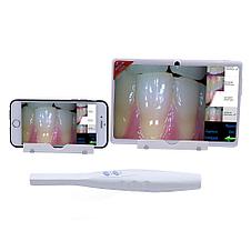 Интраоральная Wi-FI камера. Беспроводная вай фай камера для стоматологии., фото 2