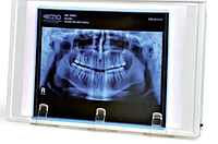 Стоматологический негатоскоп светодиодный 203*298 мм (Яркость 2000 кд/м²)
