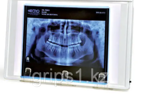 Стоматологический негатоскоп светодиодный 203*298 мм (Яркость 2000 кд/м²) - фото 1 - id-p102593576