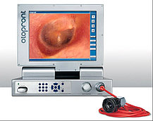 Портативная система видеоэндоскопии PES 2.1 (Otopront)