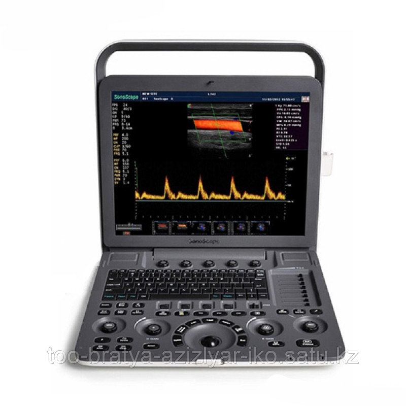 Система для ультразвуковой диагностики SonoScape S9Pro ( VISTA-платформа) - фото 2 - id-p101693123