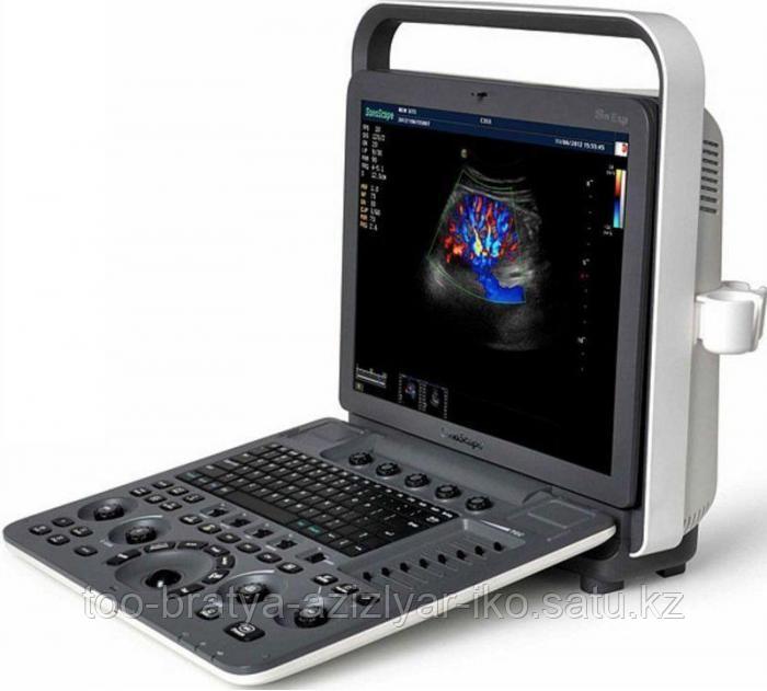Система для ультразвуковой диагностики SonoScape S8 Exp ( VISTA-платформа) - фото 2 - id-p101693124