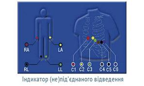 Электрокардиографы