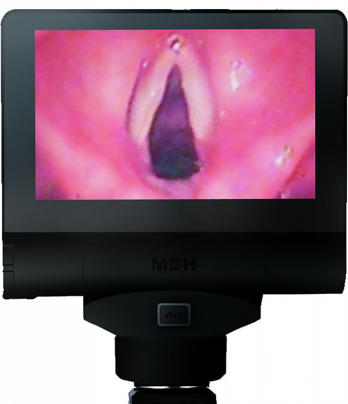 Портативный диагностический видеоэндоскоп MDH B41 (2.8) - фото 4 - id-p102751195
