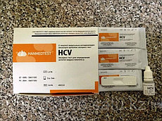Экспресс тест для определения антител вируса гепатита С (HCV) с буферным раствором