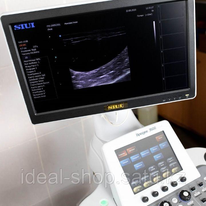 SIUI Apogee 3500 Стационарная цифровая ультразвуковая диагностическая система с цветным допплером - фото 5 - id-p103169239