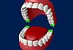 Удаление зуба - 8го зуба верхний (зуб мудрости) (1ед) 8К, фото 4