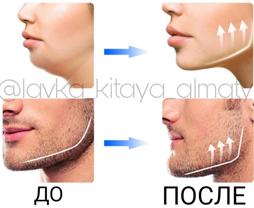 Тренажер для челюстей/ Эспандер для скул