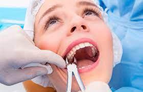 Удаление зуба - 8го зуба нижний (зуб мудрости) (1ед) 10К