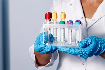 СОЭ (скорость оседания эритроцитов) (Erythrocyte Sedimentation Rate, ESR)