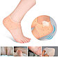 Силиконовые носочки для пяток Heel Anti-Crack Sets, фото 2