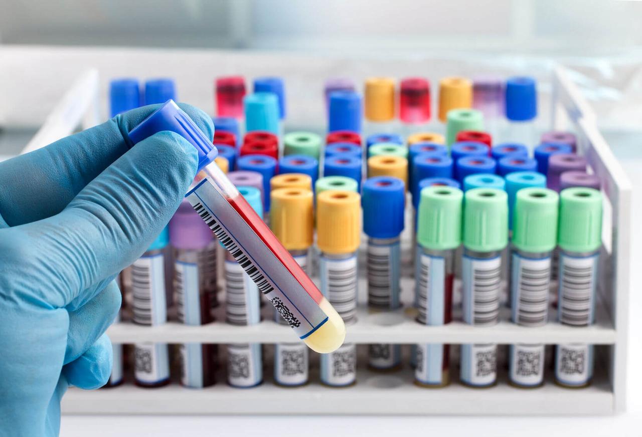 Микоплазма (Mycoplasma hominis), определение ДНК в соскобе эпителиальных клеток урогенитального тракта