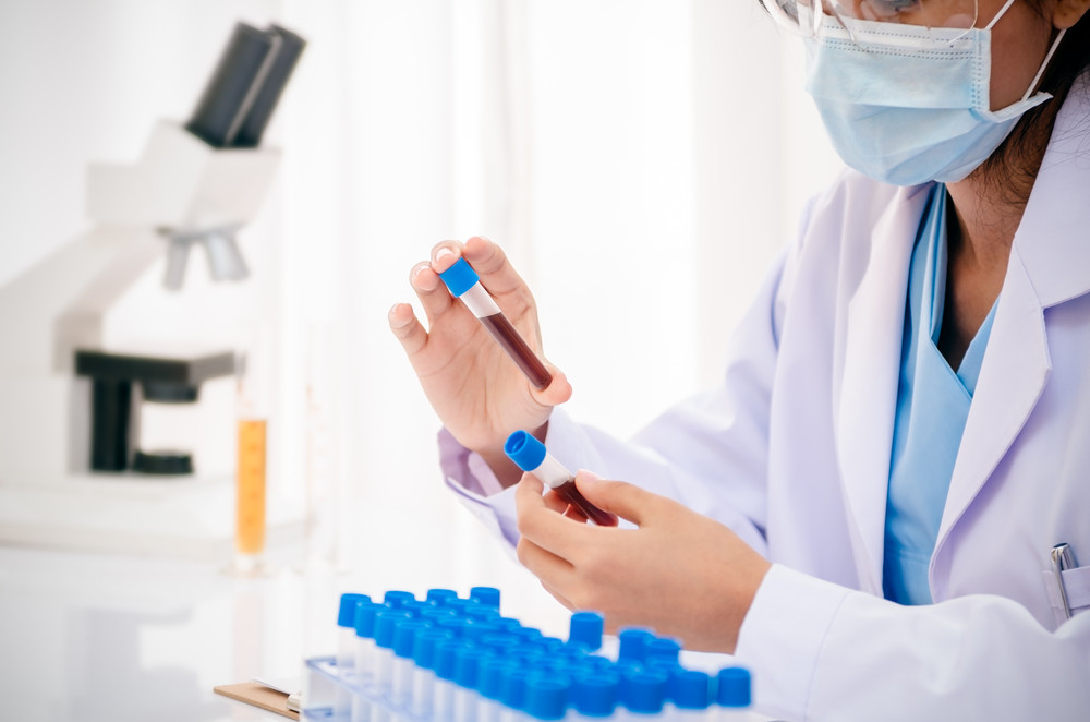 Выявление возбудителей ИППП (4 + КВМ): определение ДНК Chlamydia trachomatis, Neisseria gonorrhoeae,