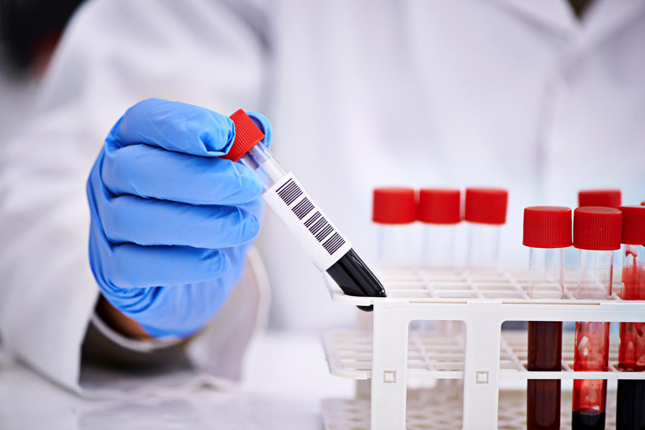 РПГА с Salmonella gr.A (Salmonella gr.A, IHA)