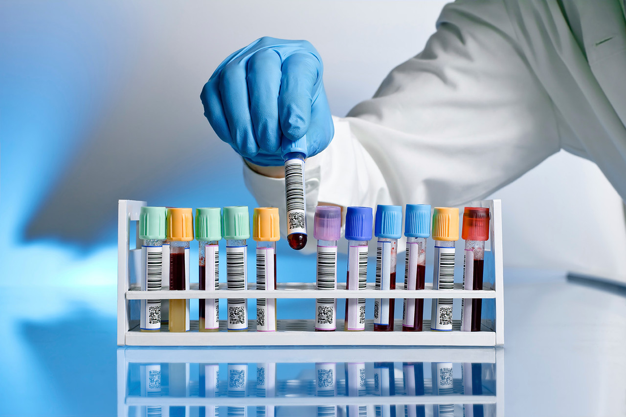 Иммуноглобулины класса G (Immunoglobulin G, IgG)