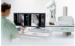 Многофункциональный цифровой рентгеновский аппарат Shimadzu Sonialvision G4 с поворотным столом-штативом