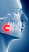 Удаление зуба - 8го зуба верхний (зуб мудрости) (1ед) 8К, фото 6