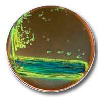 Агар с эозином и метиленовым синим (emb agar) - фото 1 - id-p104636921