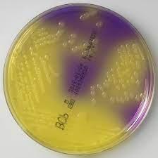 Глюкозный агар с бромокрезоловым пурпурным - фото 1 - id-p104637090