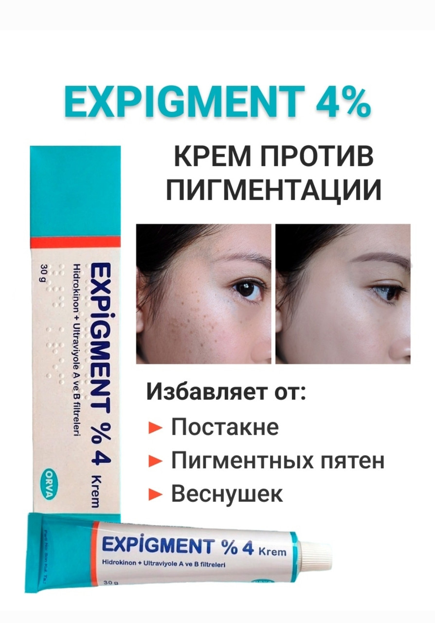 Крем отбеливающий Expigment с содержанием гидрохиона 4% 30 gr - фото 2 - id-p104889930