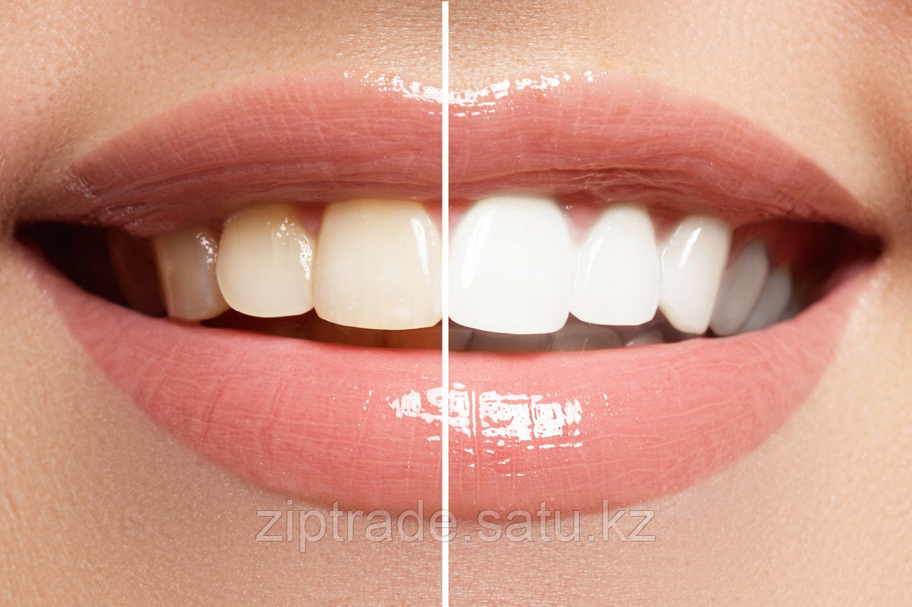 Системы отбеливания зубов Opalescence PF 16% дыня 2 шприца - фото 3 - id-p105910591