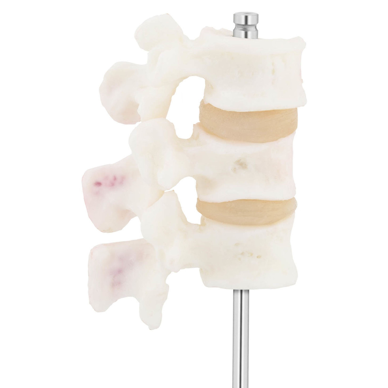 3D анатомическая модель поясничного остеопороза 3-5 позвонков - фото 3 - id-p106290491