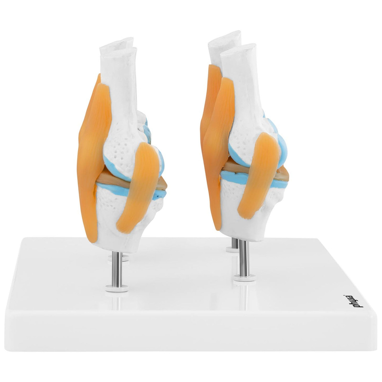 3D анатомическая модель коленного сустава с очагами поражения 4, масштаб 1:2 - фото 4 - id-p106290518
