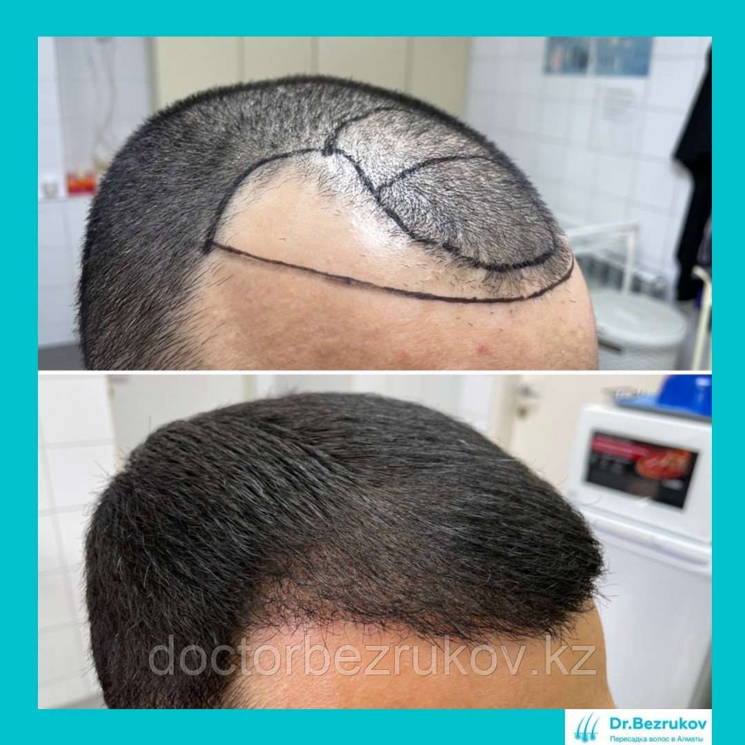 Восстановление волос в Казахстане Алматы - фото 3 - id-p1445278