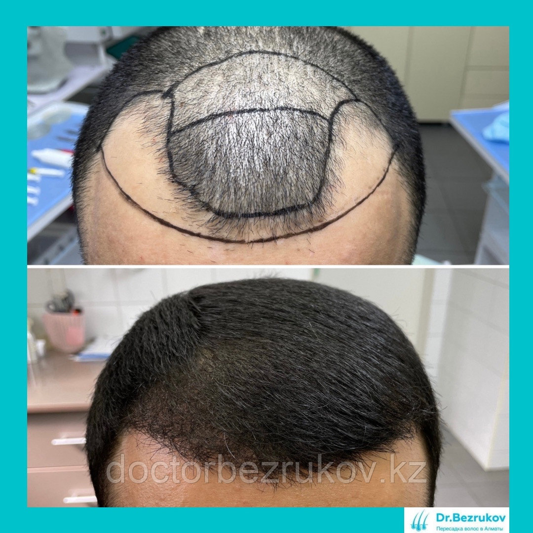 Восстановление волос в Казахстане Алматы - фото 2 - id-p1445278