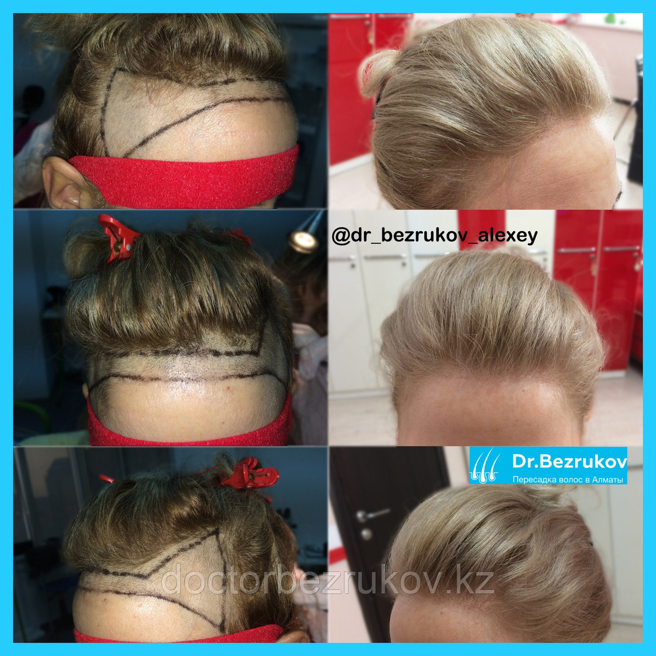 Восстановление волос в Казахстане Алматы - фото 1 - id-p1445278