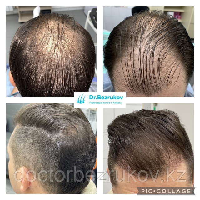 Қызыл шаштың транзакцияланған фотосы