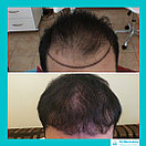 Наращивание волос в Казахстане Алматы, фото 8