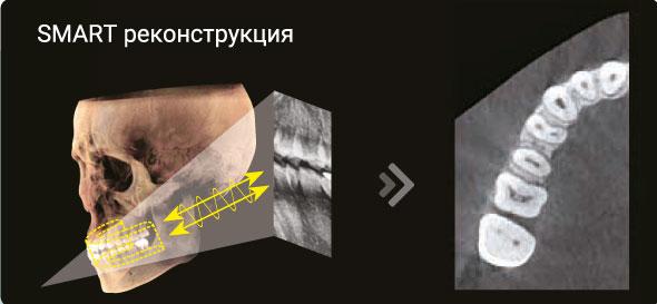 Аппарат рентгеновский дентальный цифровой панорамный Smart Plus 3D - фото 8 - id-p106526884