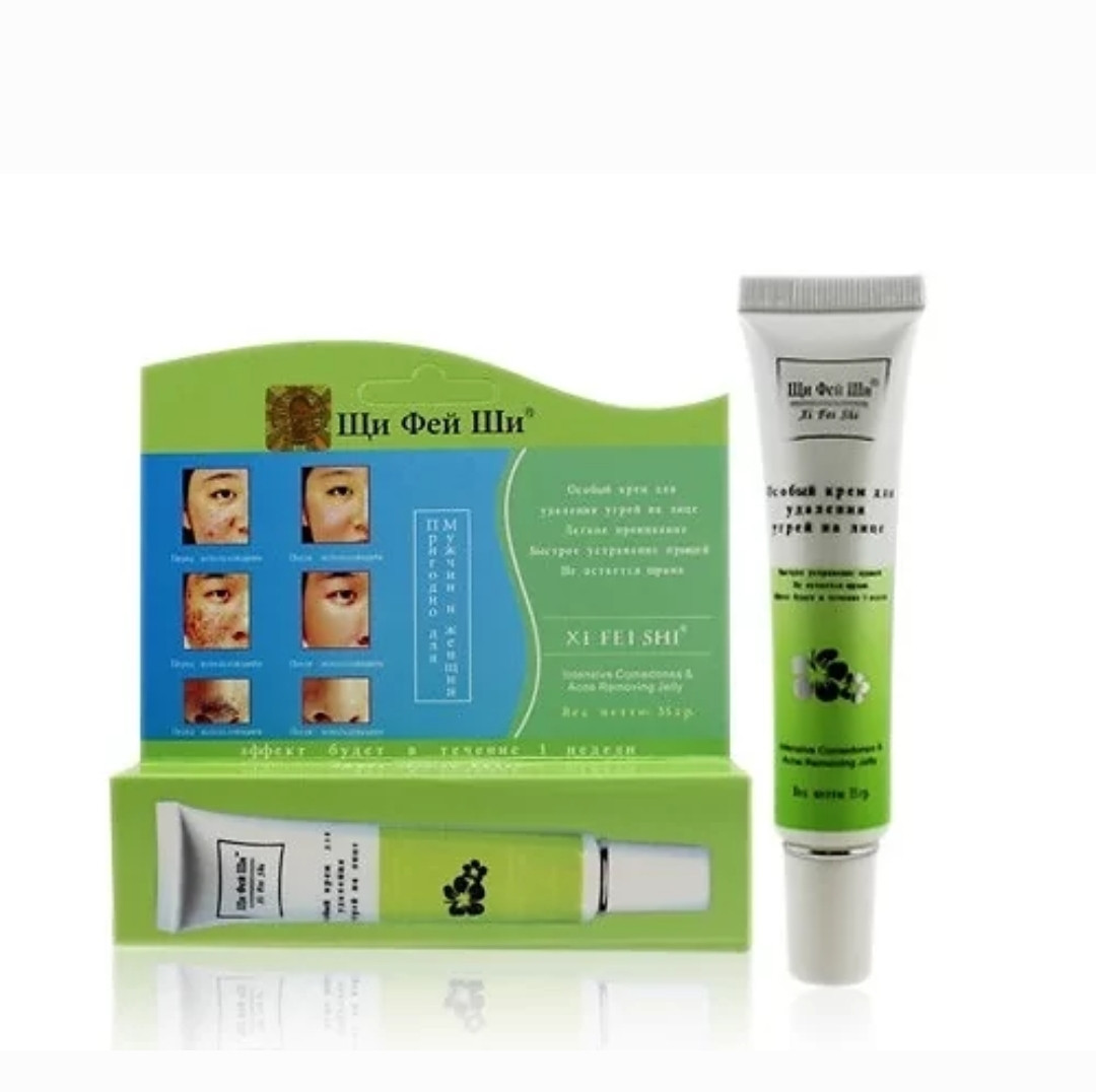Антибактериальный гель от угрей и акне «Xi fei shi» 35 гр