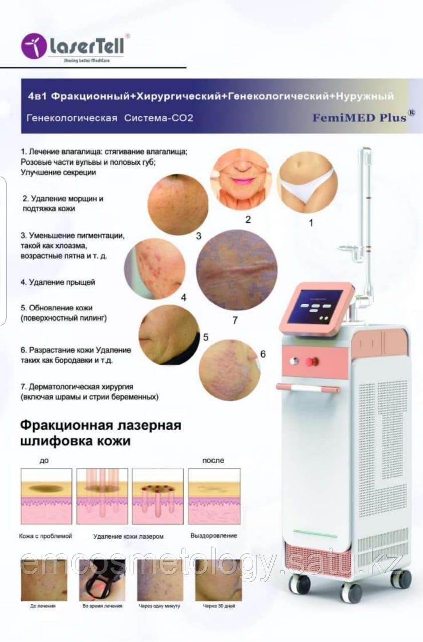 Аппарат Co2 4 в1 для подтяжки лица и омоложения FemiMEO PIus (LaserTell) - фото 4 - id-p108765321