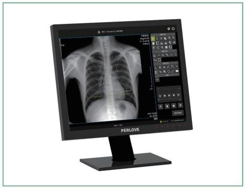 Высокоточный цифровой рентген PLD7300A интеллектуальный U-образный рычаг DR - фото 8 - id-p109100892