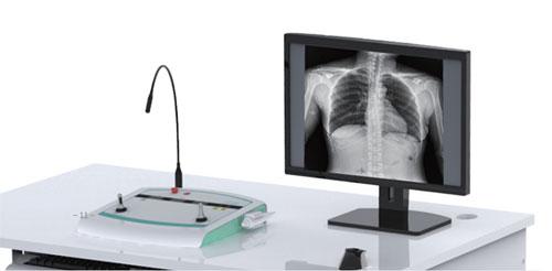 Цифровая Рентгеновская система PLD7900С - фото 2 - id-p109100978