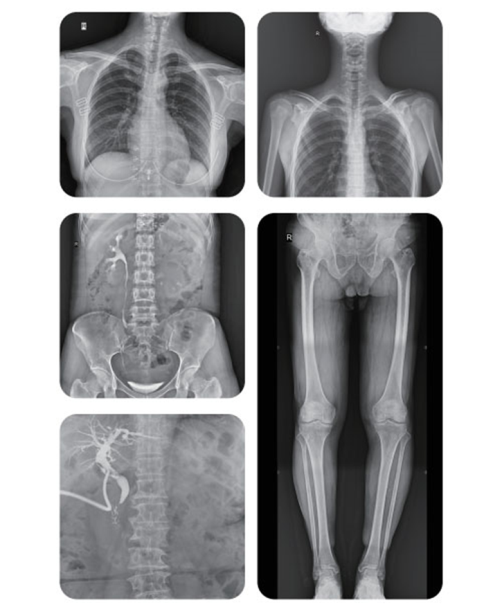 Цифровая Рентгеновская система PLD7900С - фото 5 - id-p109100978
