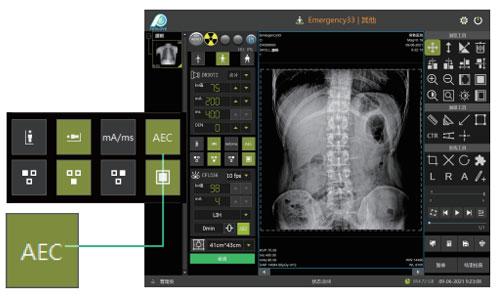Цифровая Рентгеновская система PLD7900С - фото 7 - id-p109100978
