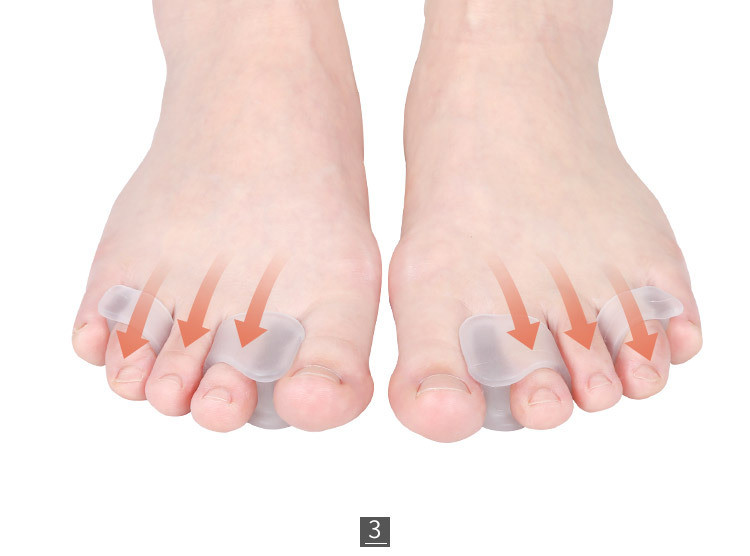 Разделитель для пальцев ног, второй и четверной палец - фото 3 - id-p109233103