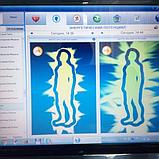 Гидроплазма «AQUA Life» - живая вода. Инюшин В., фото 5