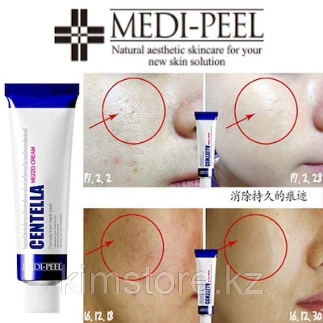 Успокаивающий восстанавливающий крем для лица Centella Mezzo Cream Medi Peel - фото 1 - id-p110968741
